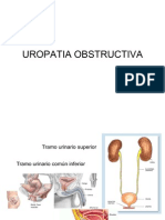 Uropatia Obstructiva