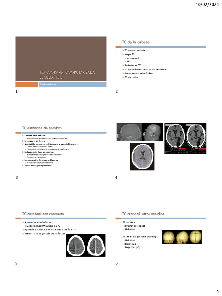 Protocolos Tc Pdf Ct Scan Aorta