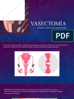 Vasectomía 2