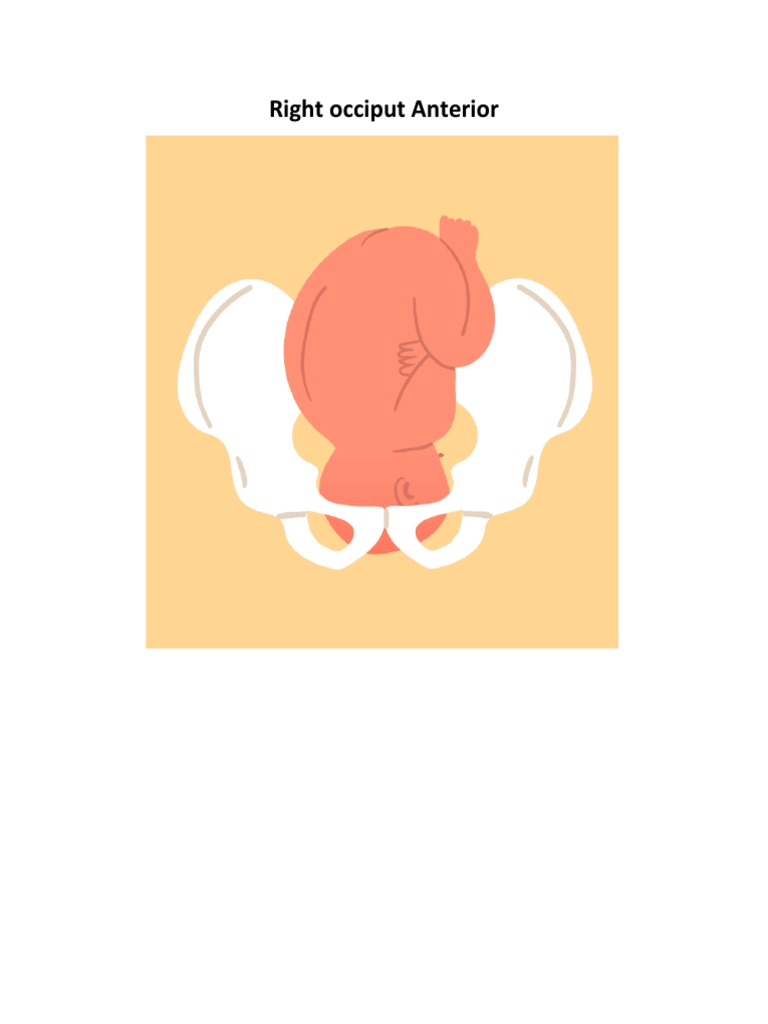 Right Occiput Anterior PDF
