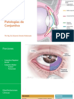 Patologías Conjuntivales