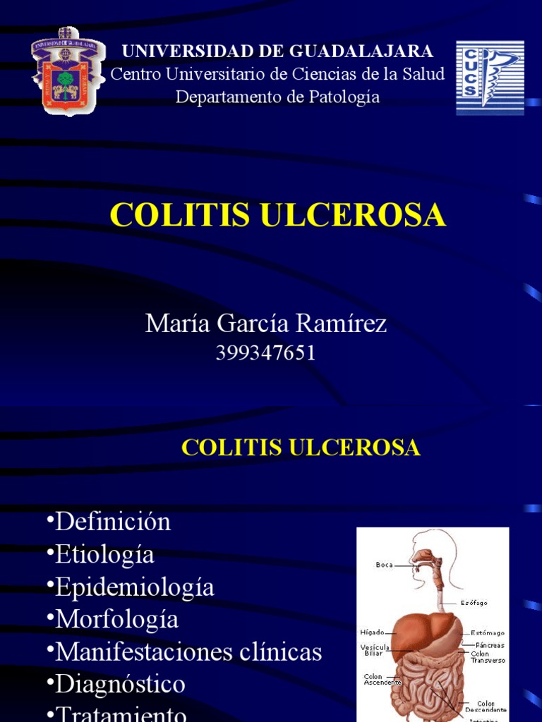 Colitis Ulcerosa | PDF | Diarrea | Cáncer