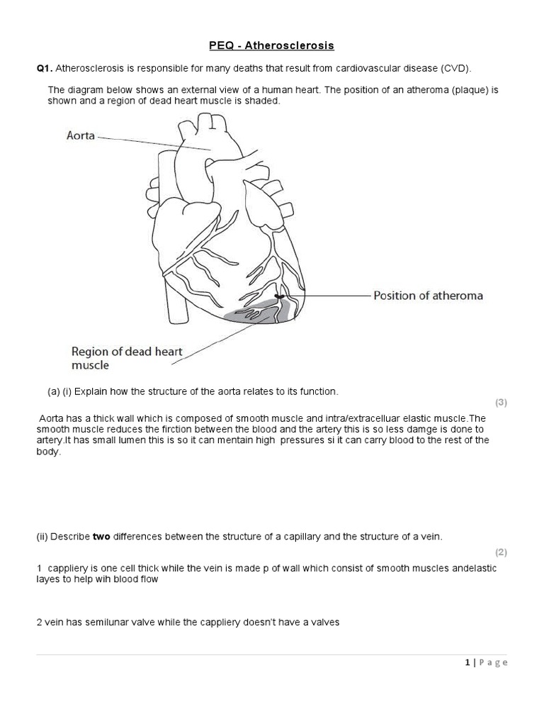 Atherosclerosis Edexcel Done Pdf Atherosclerosis Artery