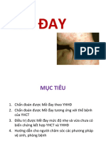 MỀ ĐAY 2021