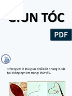 Giun Tóc