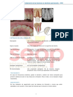 Protocolos de Tratamiento de Las Fracturas en Dentición Permanente