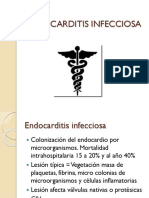 Endocarditis Infecciosa