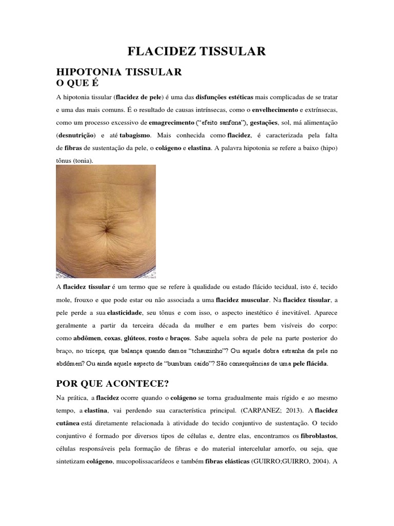 Flacidez Tissular: Causas e Tratamentos | PDF | Pele | Colágeno