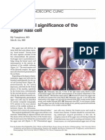 Discover the Surgical Significance of the Agger Nasi Cell