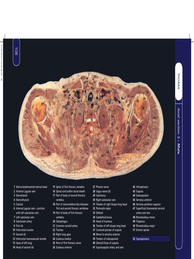 Human Sectional Anatomy Atlas of Body Sections, CT and MRI Images 4ed ...