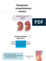 Neoplasias Renales