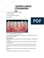 Incisivo Central e Lateral Inferiores