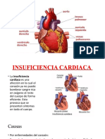 Insuiciencia Cardiaca