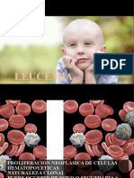 Leucemias