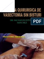 Vasectomia Tecnica
