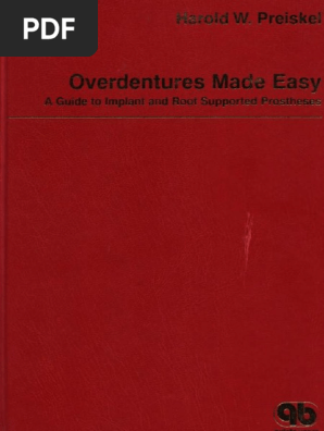 Overdentures Made Easy: A Guide to Implant and Root