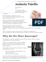 Chondromalacia Patella - Causes & Treatment - Knee Pain Explained