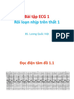 Bài Tập Th 1 - Rl Nhịp Trên Thất - Thầy Việt