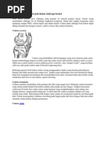 Download Cidera Yang Sering Terjadi Dalam Olahraga Basket by Rishiwi Jjaimee Jelegh SN61594314 doc pdf