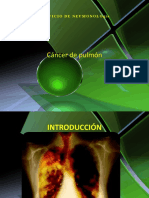 Cancer de Pulmon ESTUDIANTES