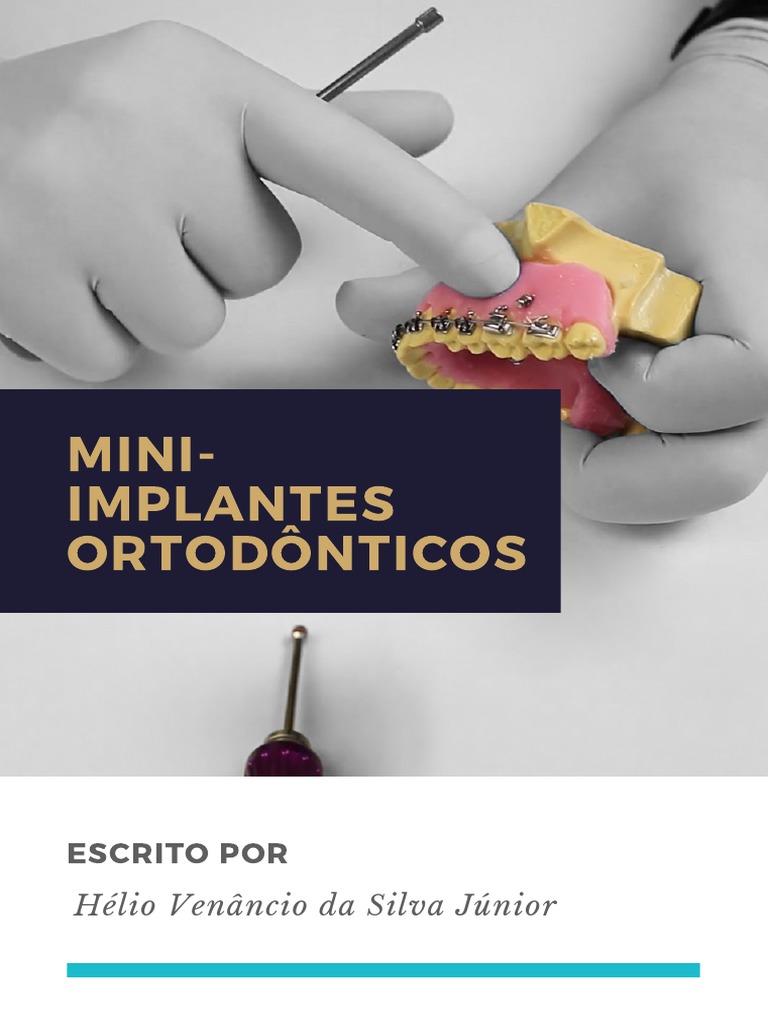 EBook MPO | PDF | Dente | Ortodontia