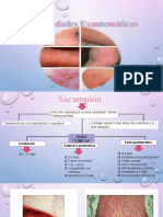 Enfermedades Exantemáticas
