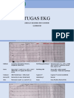 Tugas EKG (Zabella Silviana Dwi Cahyani 122810150) (1) (Read-Only)