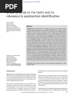 Effect of Acid On Teeth and Its Relevance in Postm