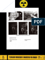 09-Radiologia convencional com contraste