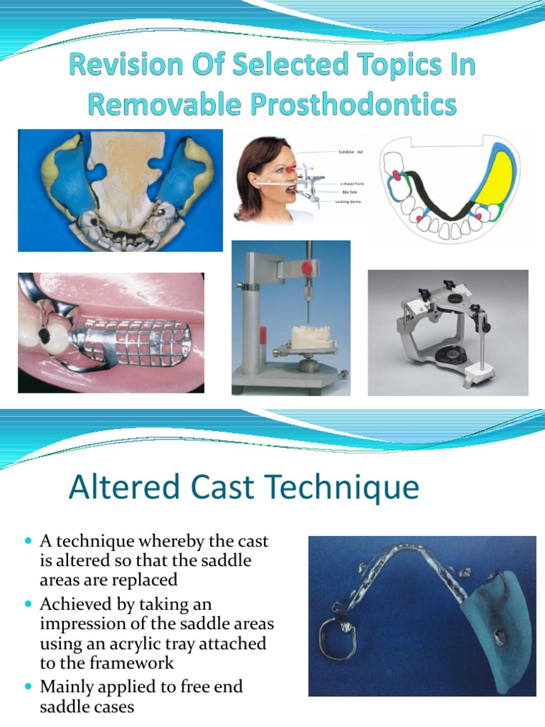 Review of Selected Topics in Removable Prosthodontics PDF Dentistry