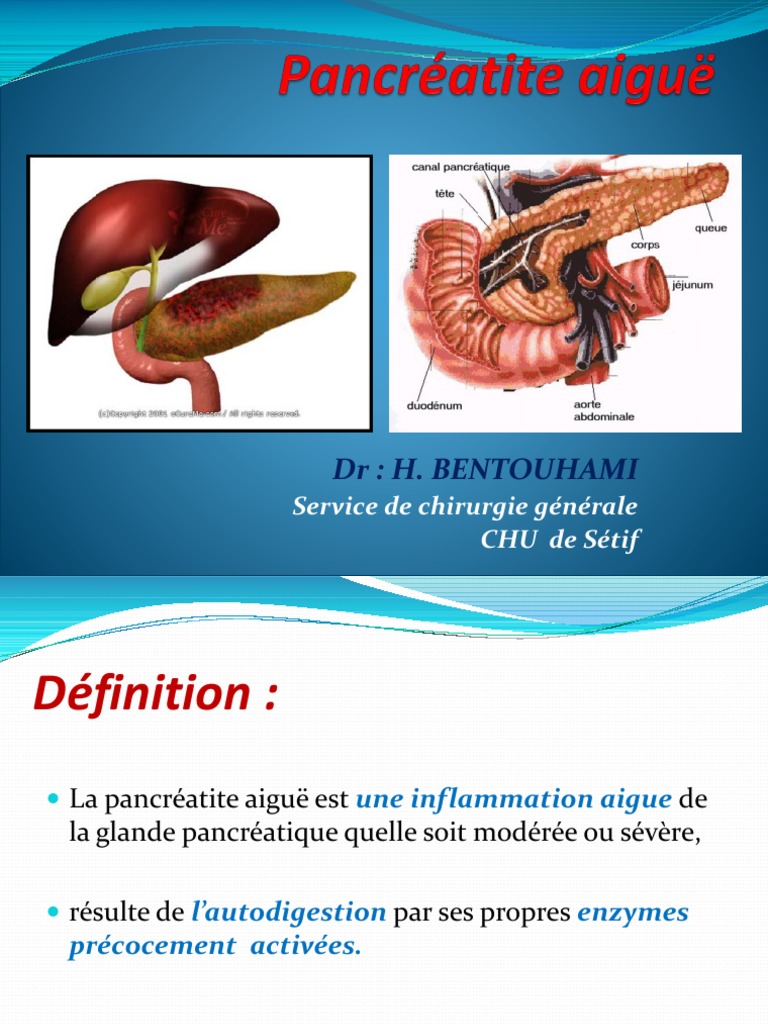 30.04.pancréatite Aiguë | PDF | Médecine clinique | Spécialités ...
