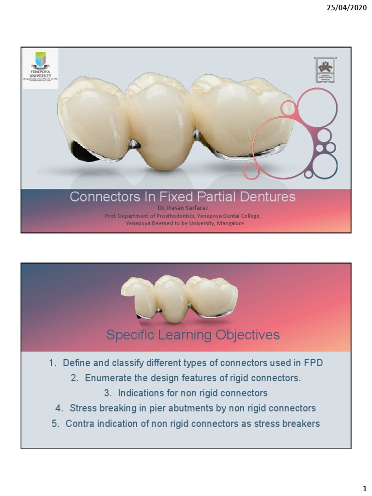 Connectors in Fixed Partial Dentures | PDF | Dental Implant | Dentistry ...