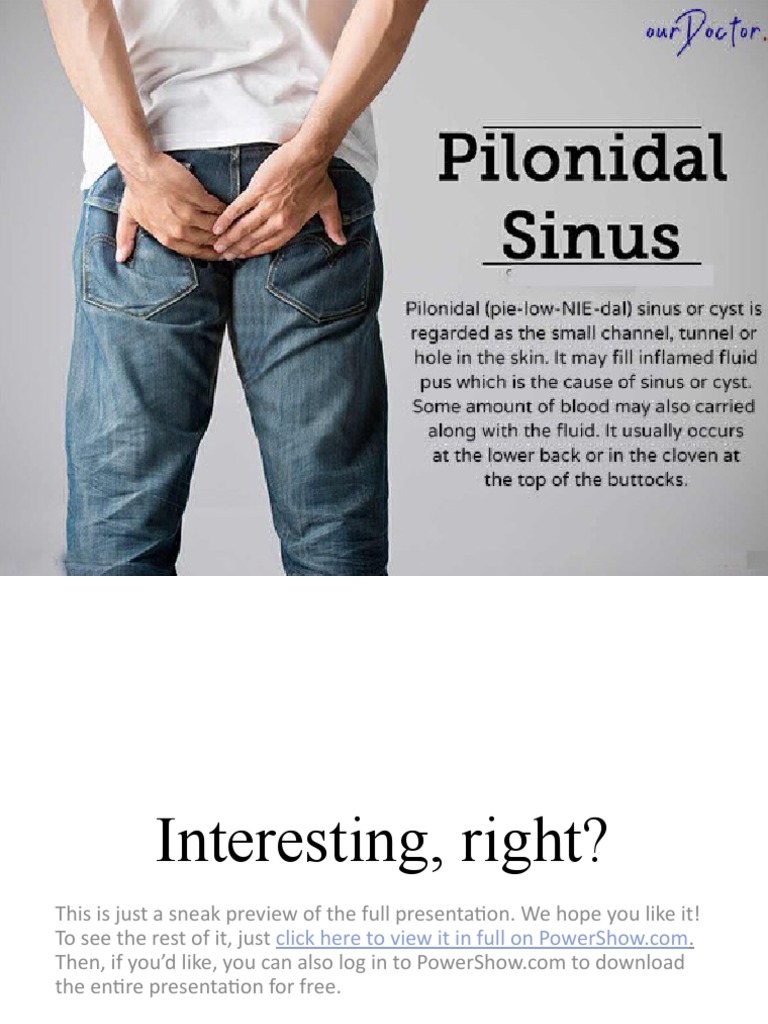 Pilonidal Sinus Presentation Preview | PDF