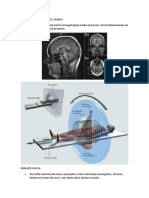 Cortes Tomograficos Del Craneo