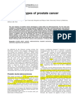 Unusual Subtypes of Prostate Cancer