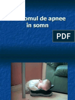 Sindromul de Apnee in Somn