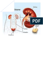 گردوں کیلیے نقصان دہ 6 اشیاء