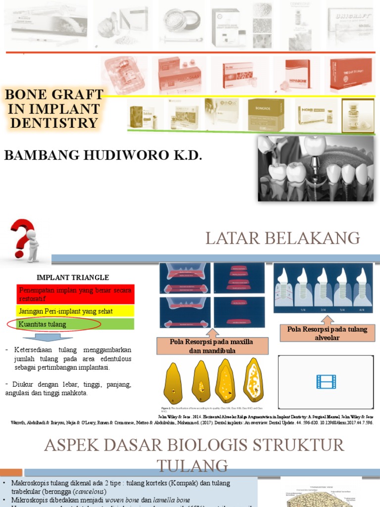 Ilmiah Bone Graft Dental Implant PDF