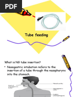 Tube Feeding