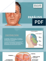Paralisis Facial Edu2022