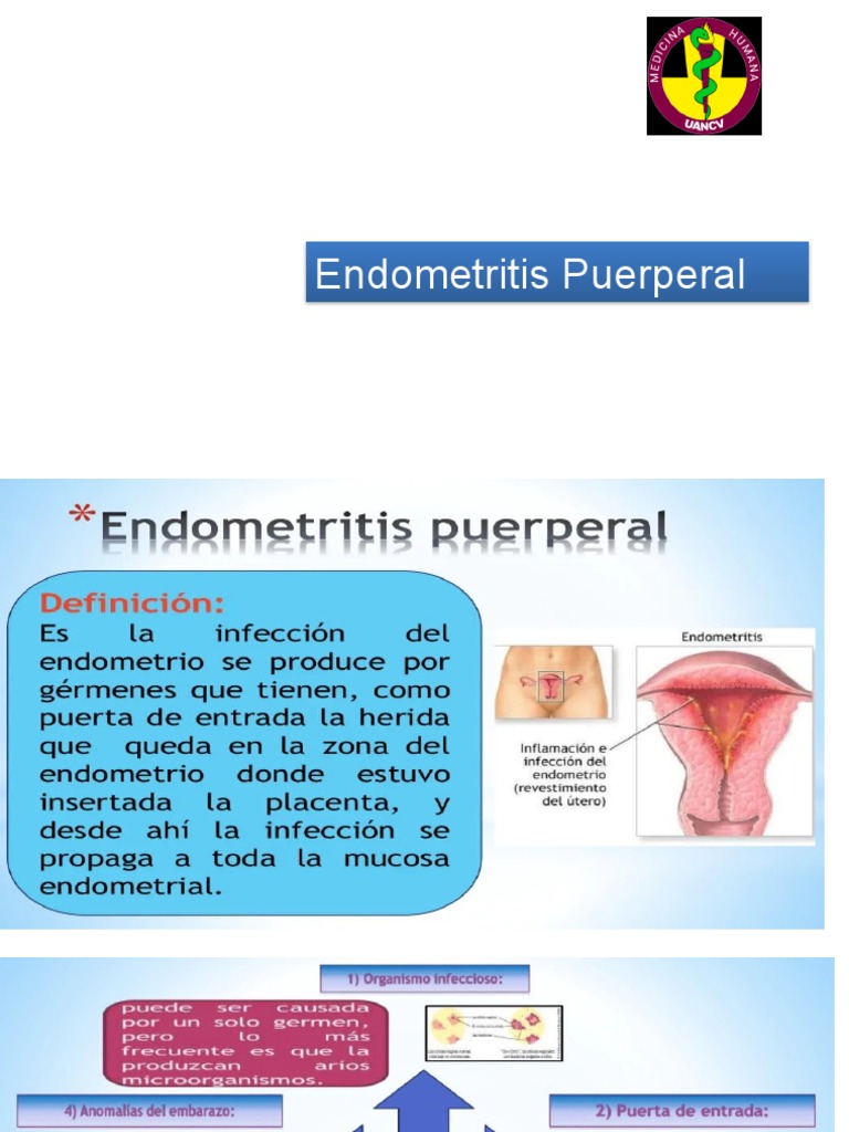 Endometritis Puerperal PDF