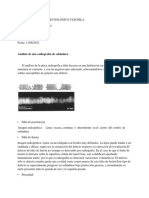 Analisis Radiografico de La Soldadura