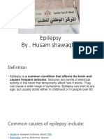 Epilepsy by Husam Shawaqfeh