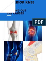 Anterior Knee Pain - Sorting Out The Causes