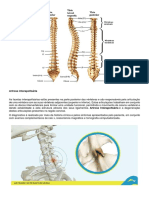 Degeneração discal e artrose interapofisária