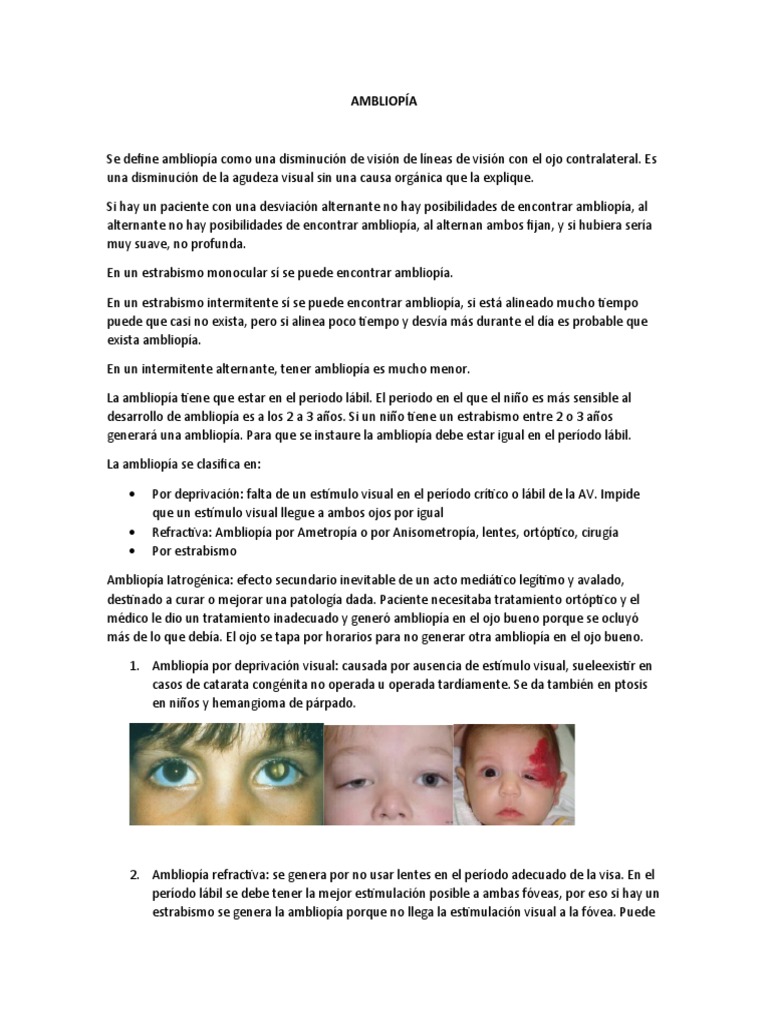 Ambliopía | PDF | Especialidades Medicas | Visión