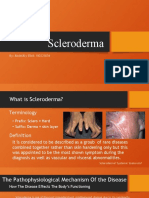 Scleroderma