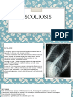 Escoliosis Diapositivas Ul.timo