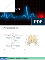 Pembacaan EKG