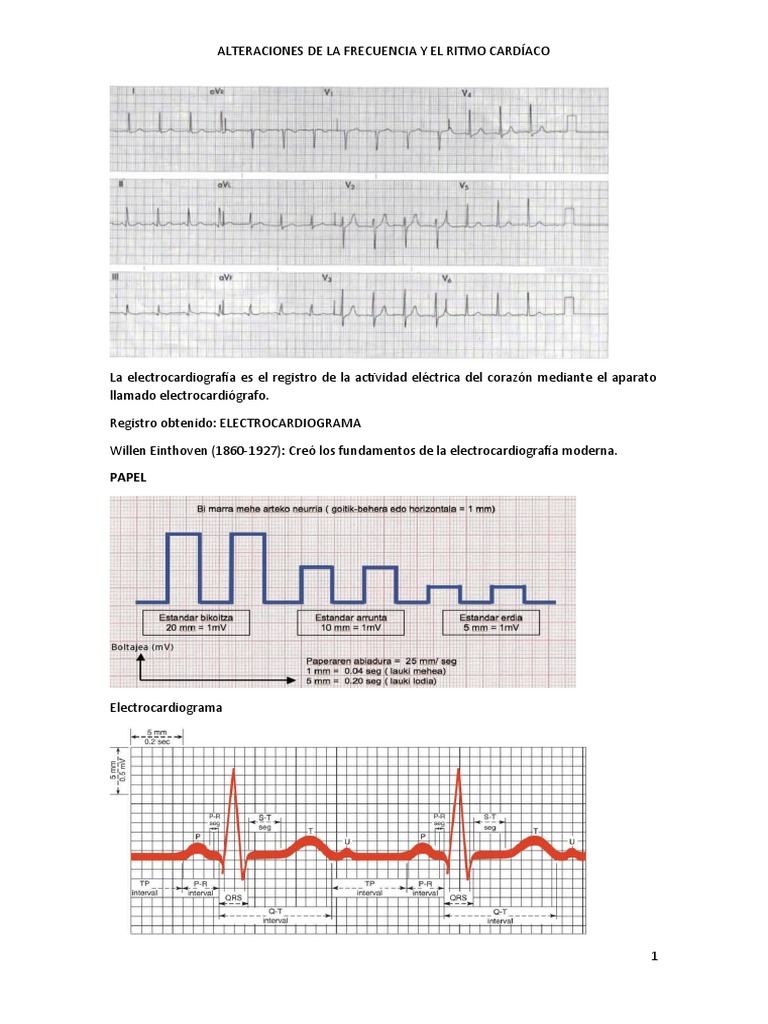 Cardio | PDF | Electrocardiografia | Infarto de miocardio